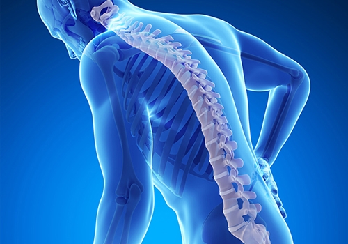 Co to jest osteoporosa? (niem. Osteoporose)